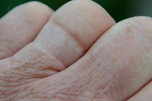 Is your Gold Jewelry Discoloring your Finger?